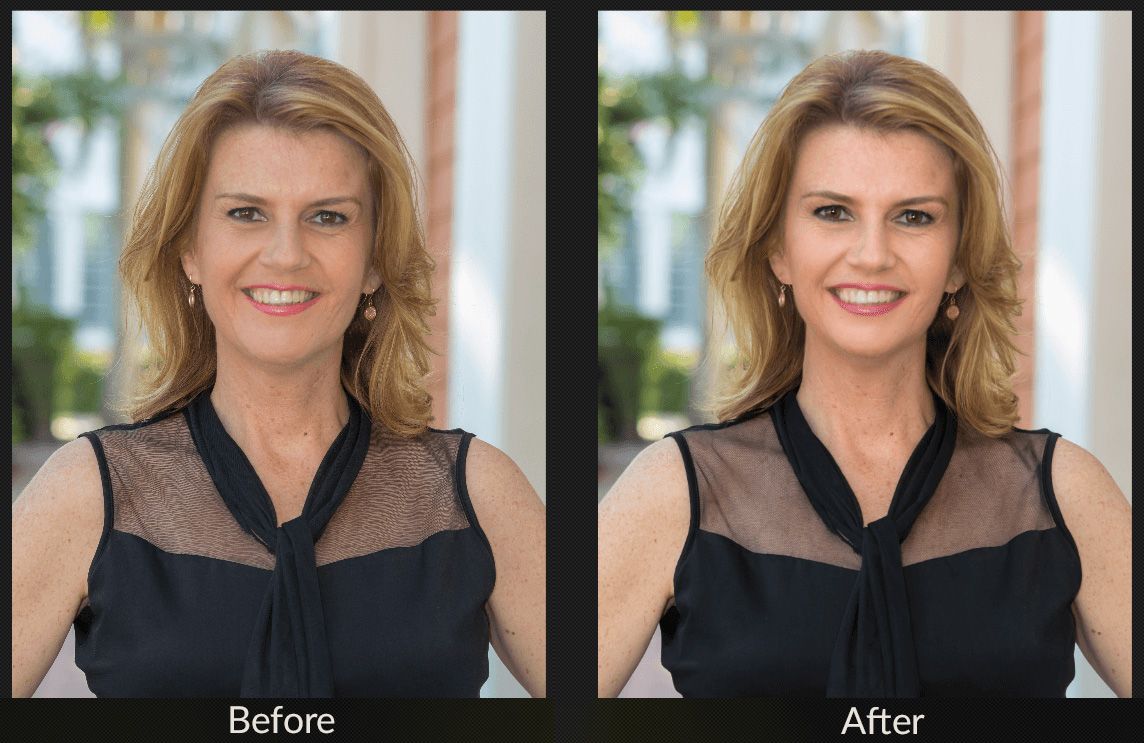 image client before and after
